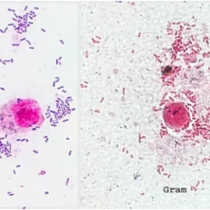 سویه باکتری Proteus mirabilis ATCC 43071